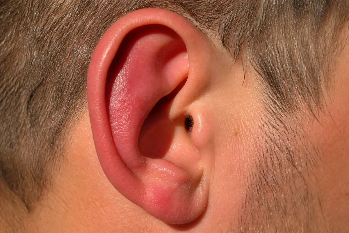 Oreille rouge et enflée indiquant une possible douleur au cartilage de l'oreille